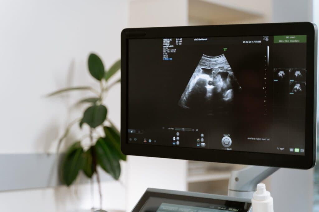 Jionee mobile diagnostic workstation showing an ultrasound scan
