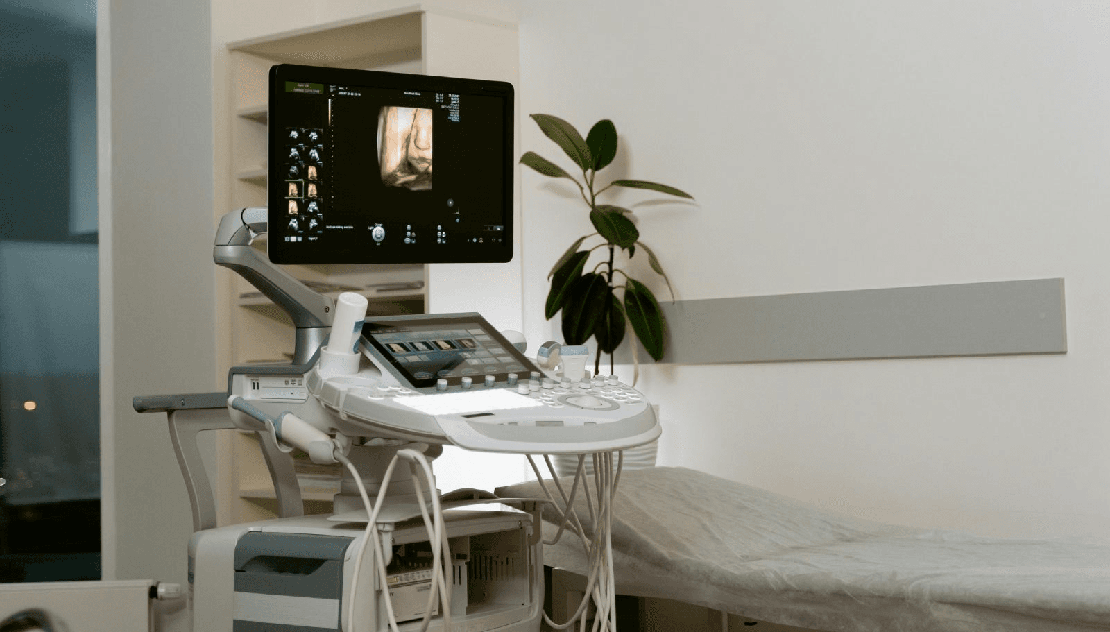 Mobile sonography — Jionee ultrasound equipment